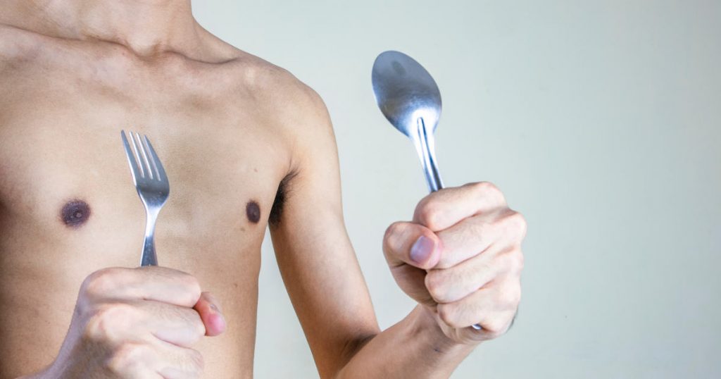 Der magere Oberkörper eines jungen Mannes ist zu sehen. Er hält Gabel und Löffel in jeweils einer Hand hoch und signalisiert damit, dass er essen und zunehmen möchte.
